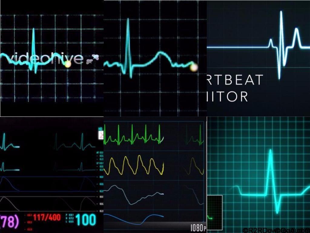 Videohive EKG Heartbeat Monitor Electrocardiogram Free Download